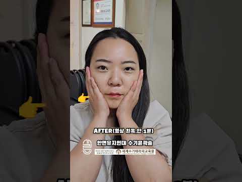 안면유지인대 수기윤곽술 단1회 3분 보정없는..
