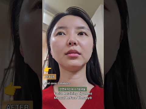 단1회 3분만의 기적같은 윤곽변화