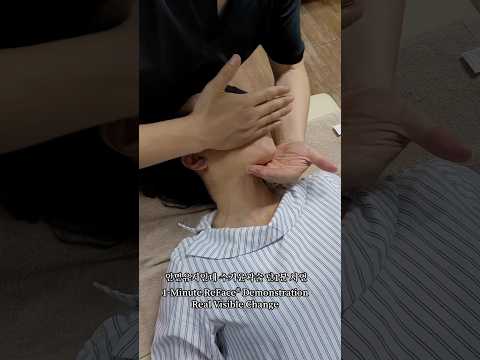 호주에서 오신 원장님 단 1회 3분만에 변화되..